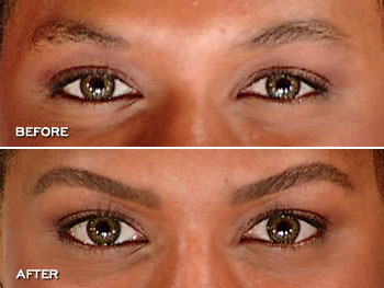 Vaseline As Eye Cream - aloe vera gel for eye wrinkles