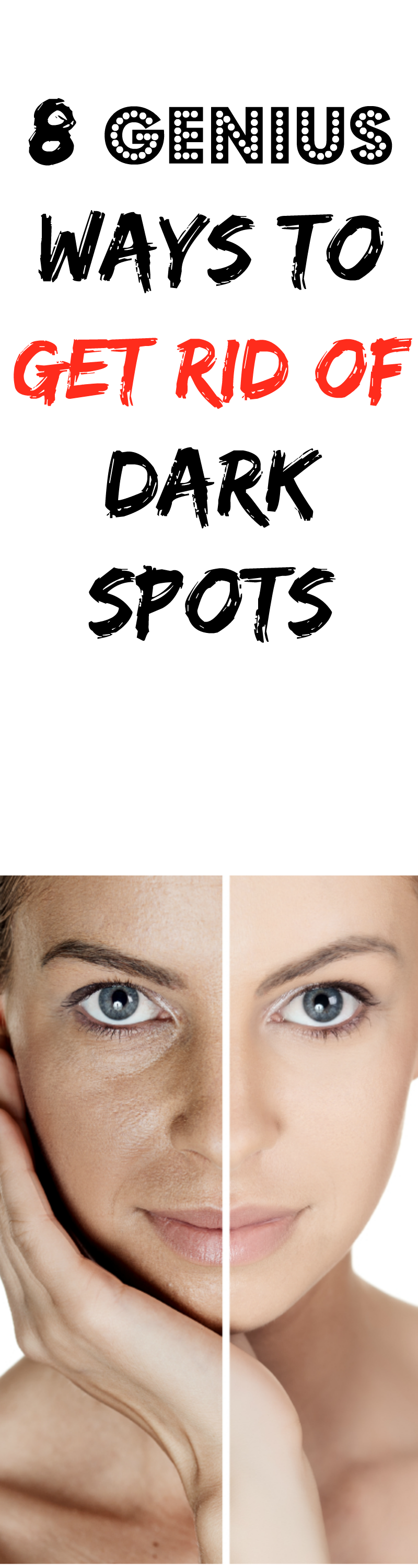 8-remedies-to-cure-dark-spots