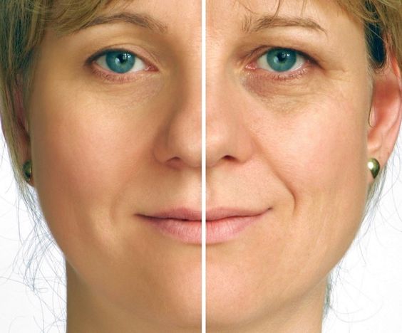 5 minute face lift
