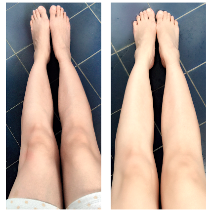 before-and-after-dark-knees