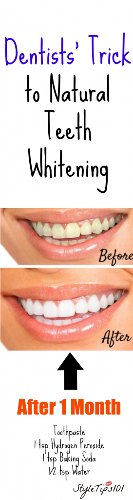 how to whiten teeth