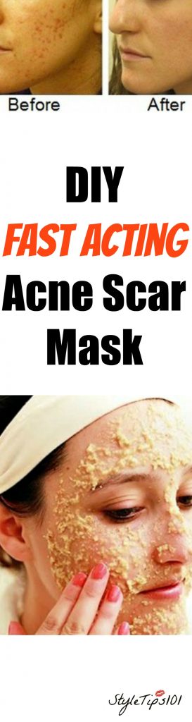 acne scar mask