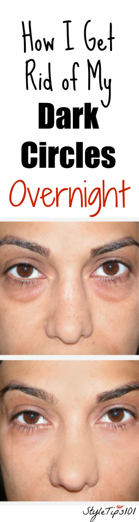 How To Get Rid Of Dark Circles Overnight