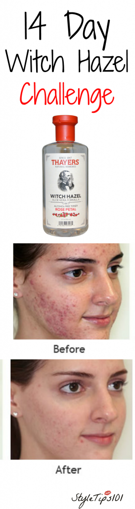 Witch Hazel Challenge