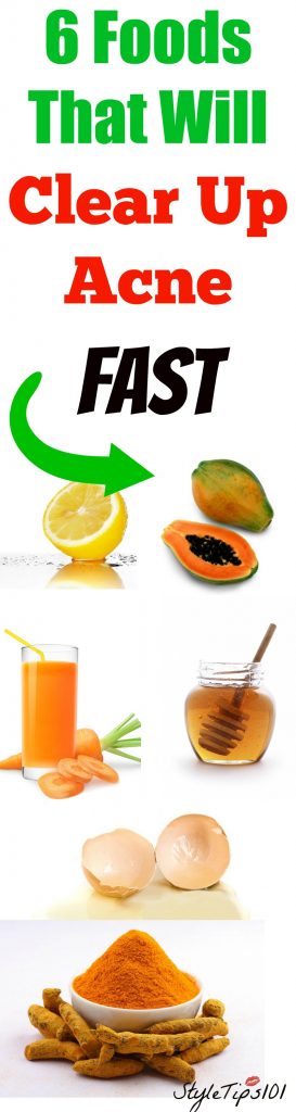 Foods That Will Clear Up Acne