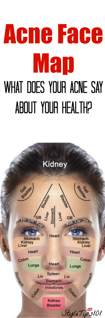 Acne Face Map What The Acne On Every Part Of Your Face Means