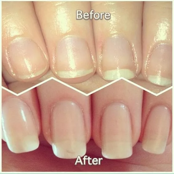Home Remedies to Make your Nails Stronger