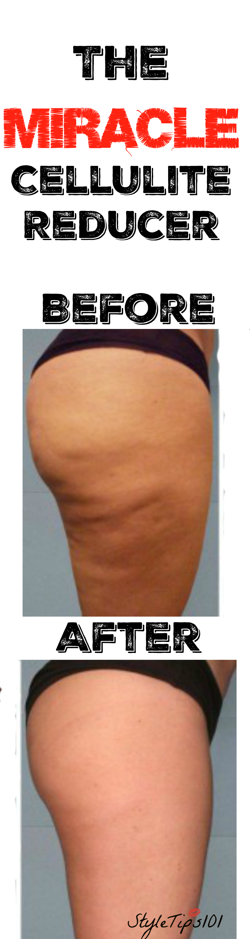 Reduce Cellulite