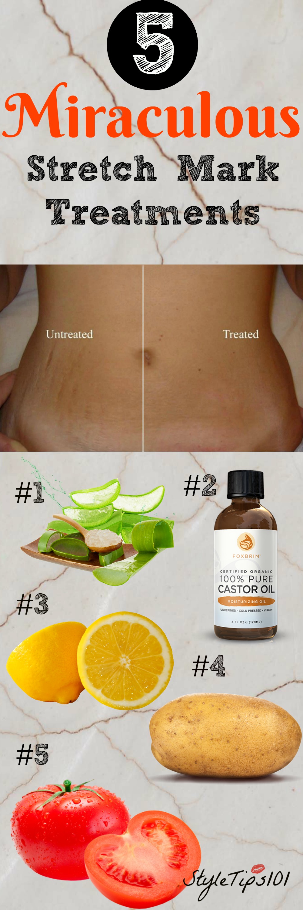 5 Homemade Stretch Mark Remedies