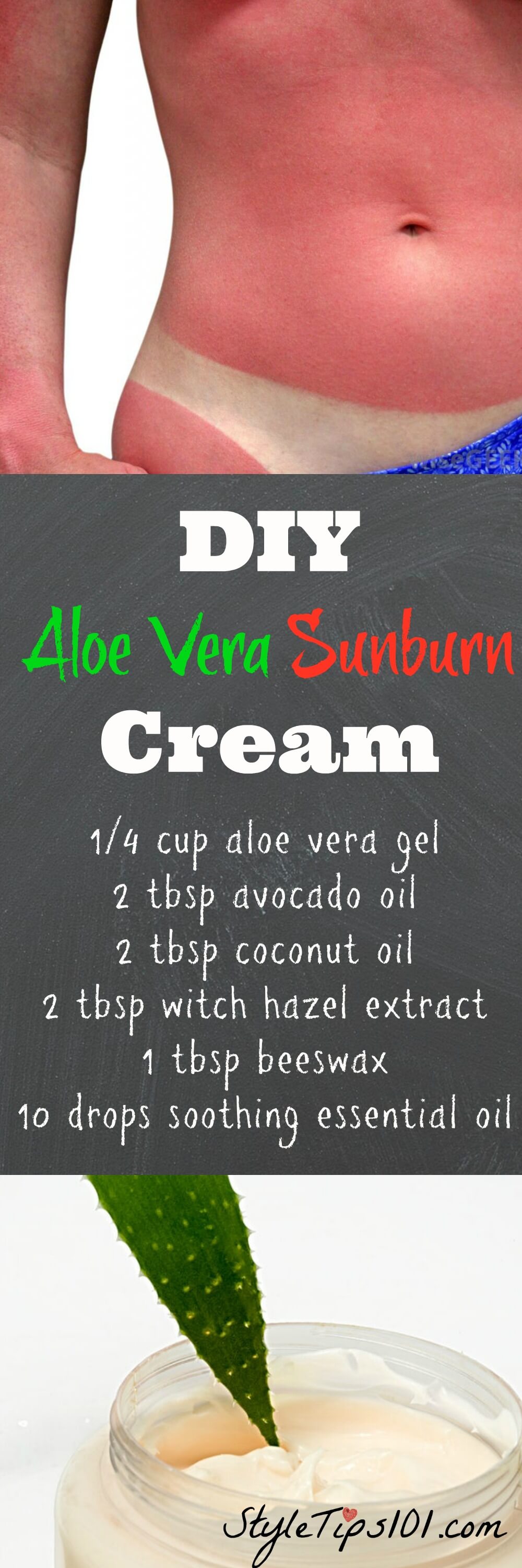 DIY Sunburn Cream With Aloe Vera