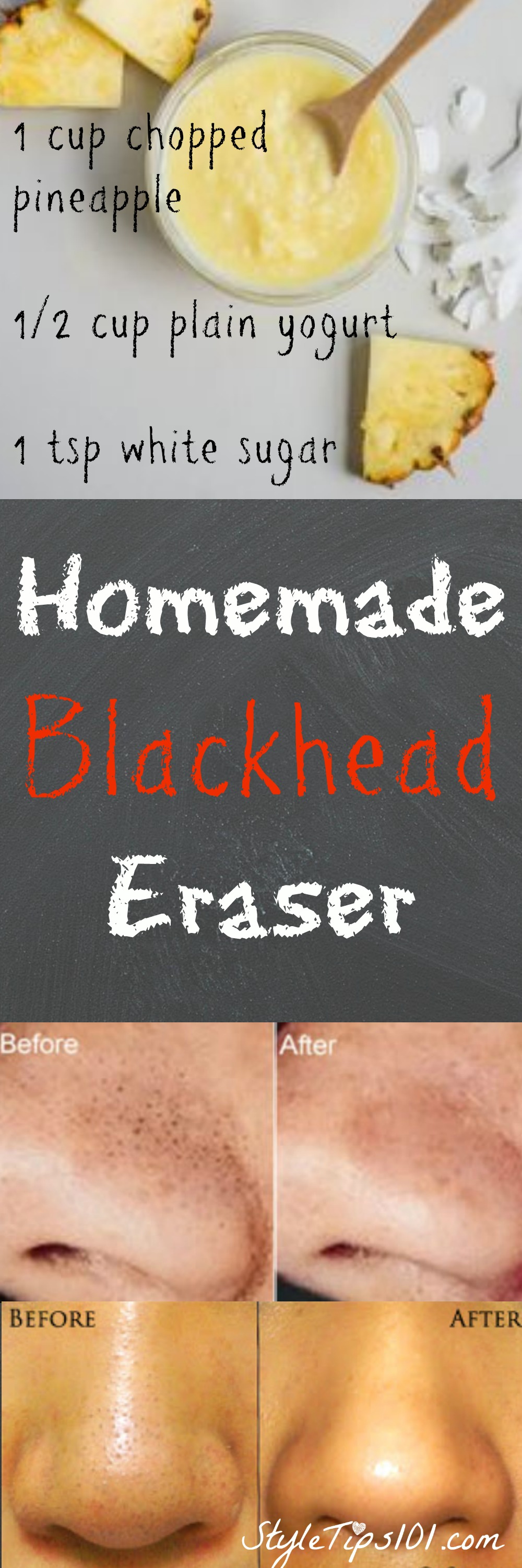 Homemade Blackhead Eraser