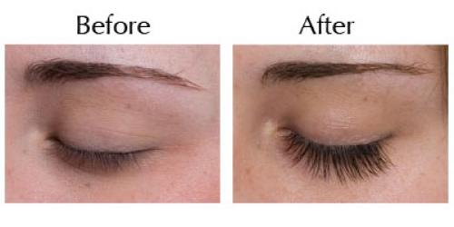 before and after eyelash growth