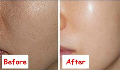 glowing skin before and after