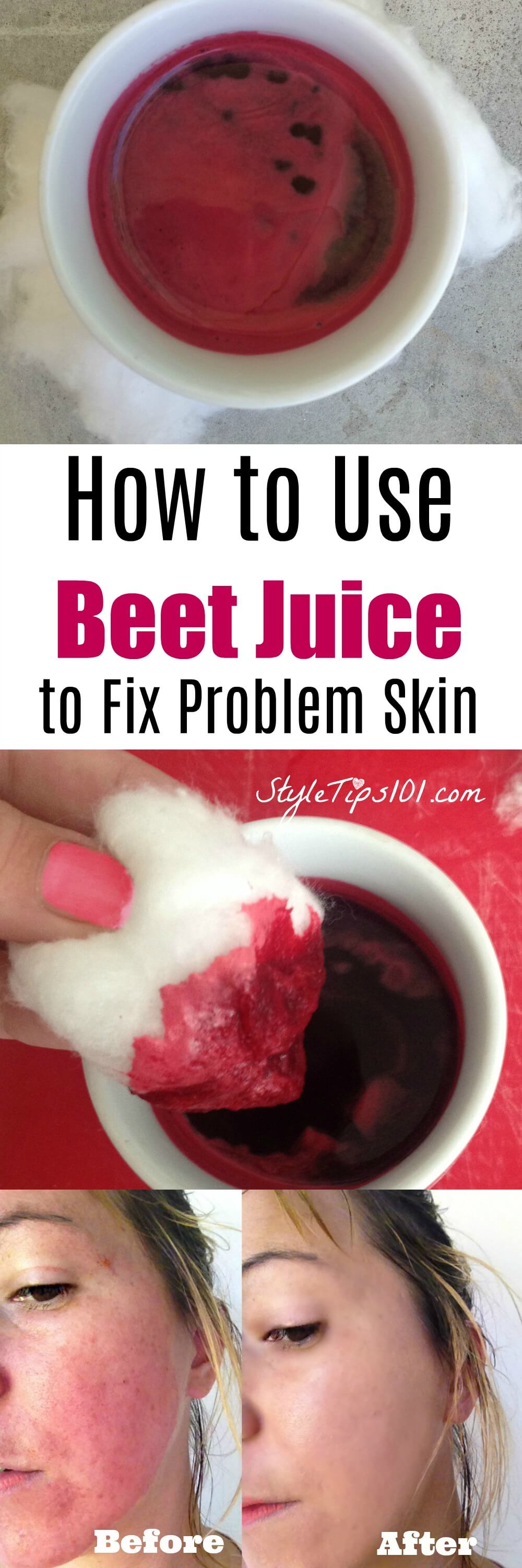 beet juice for skin