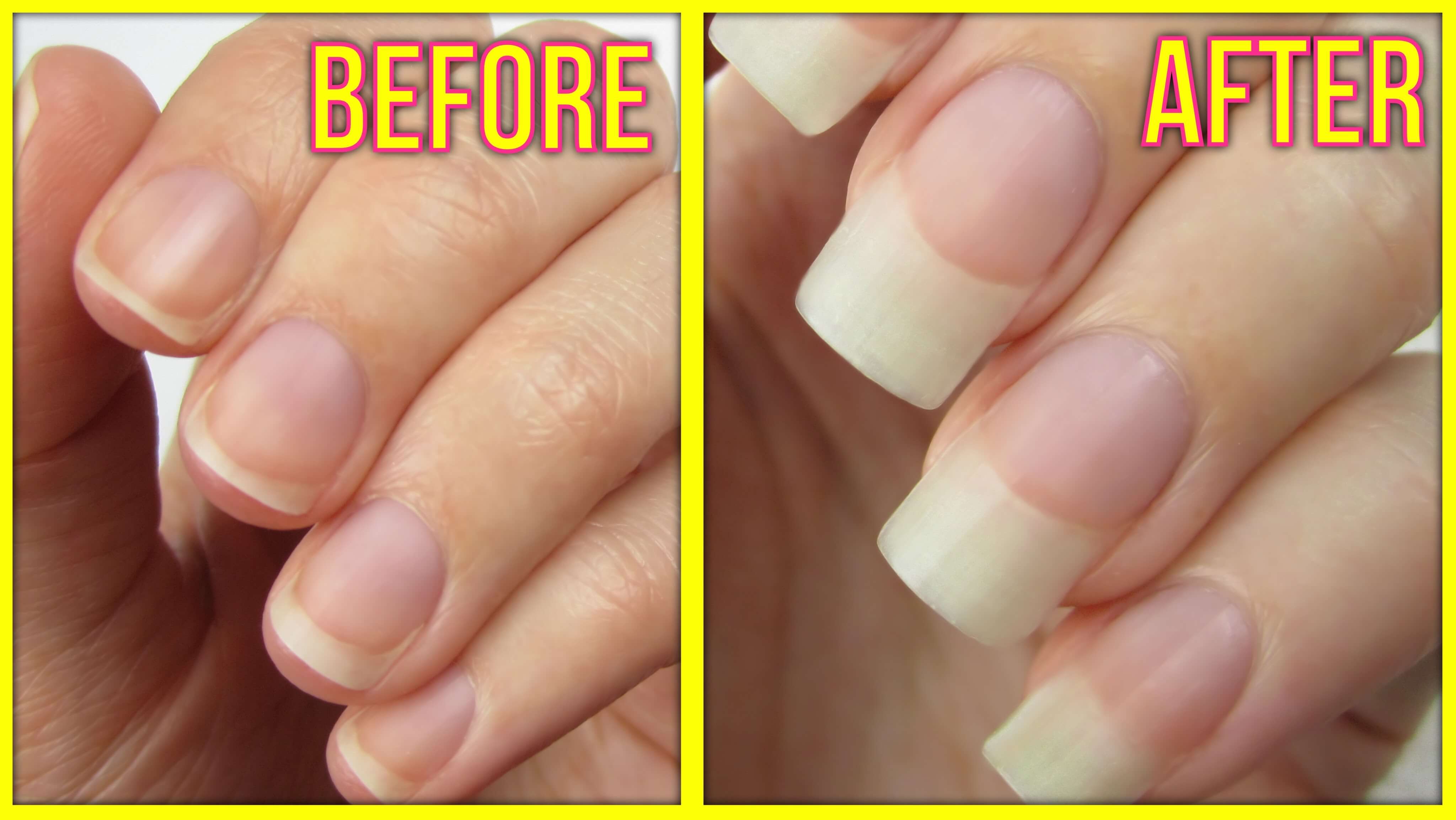 before and after nail growth