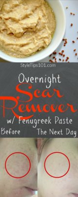 diy overnight scar remover