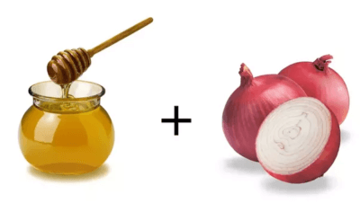 onion juice and honey