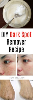 DIY Dark Spot Remover