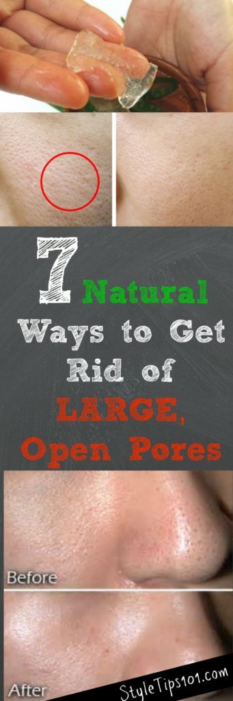 best way to clear pores