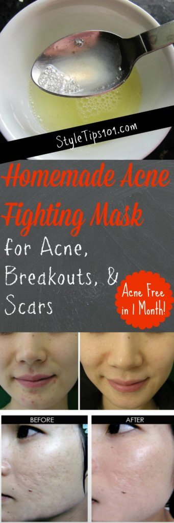 Homemade Acne Fighting Mask