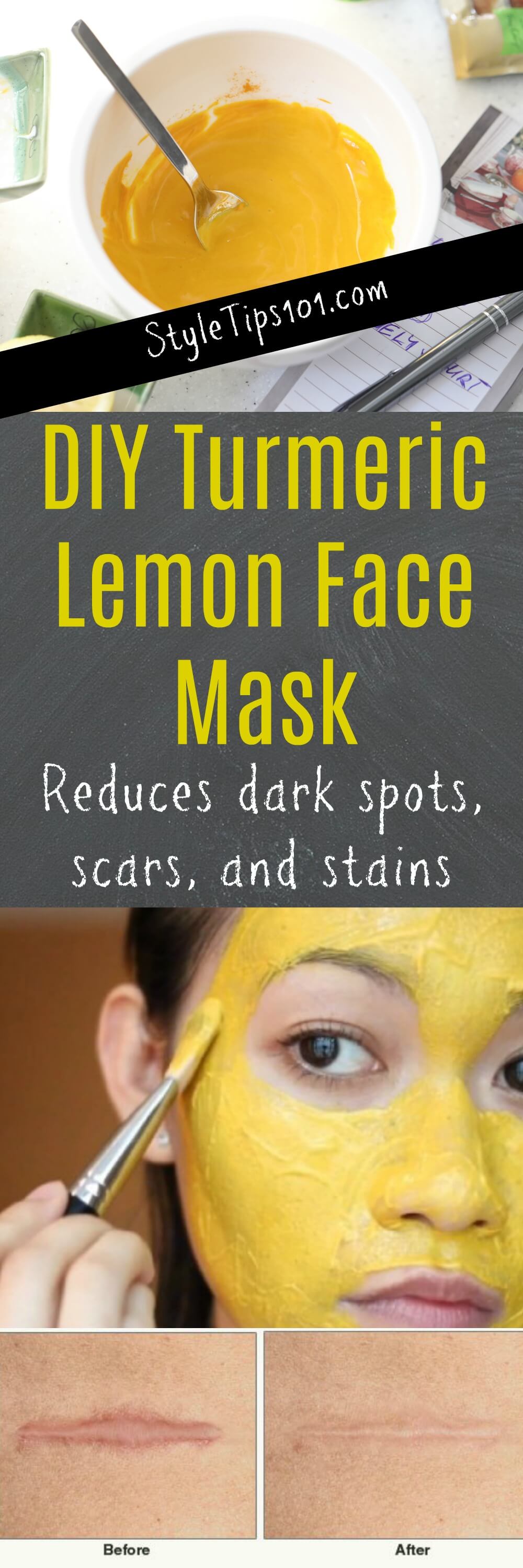 Turmeric Lemon Face Mask for Dark Spots, Scars, and Stains