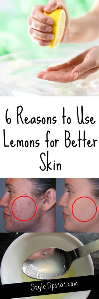 Lemon Juice For Better Skin