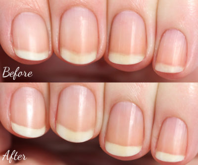 before and after cuticles