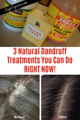 homemade dandruff treatments