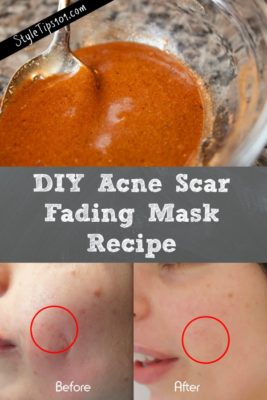 DIY acne scar fading mask