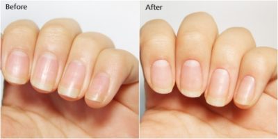 before and after cuticle cream