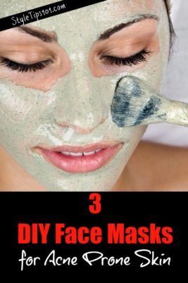 face masks for acne prone skin