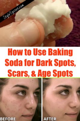 Baking Soda for Dark Spots