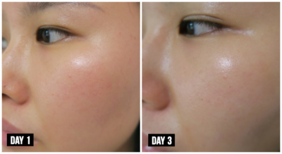 before and after serum