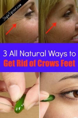 get rid of crows feet