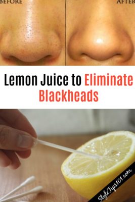 Lemon Juice to Eliminate Blackheads