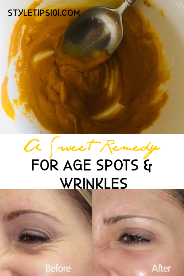 Remedy For Age Spots