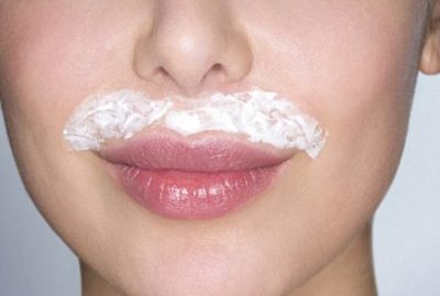 upper lip hair removal