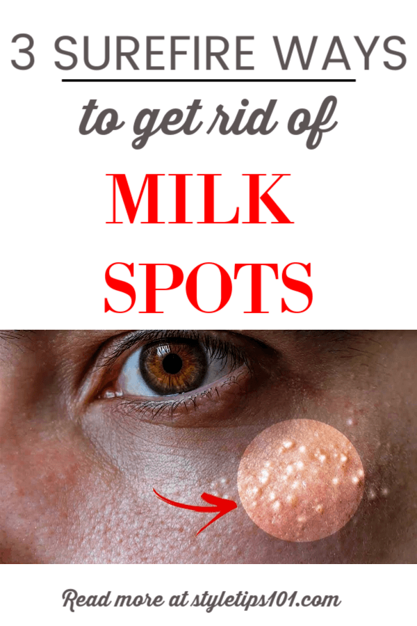 Get Rid of Milk Spots