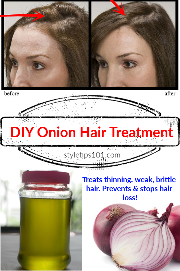 DIY Onion Hair Treatment