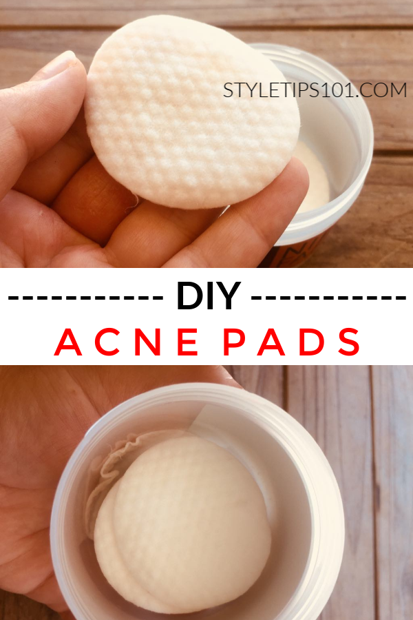 DIY Acne Pads