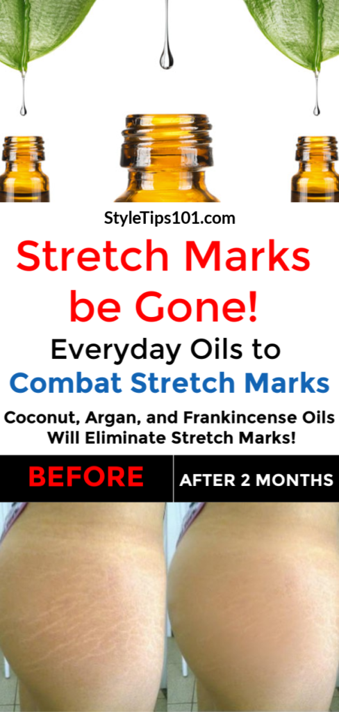 Combat Stretch Marks