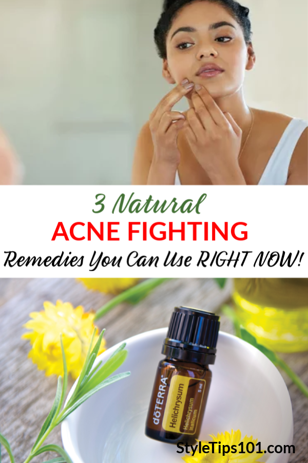 Acne Fighting Remedies