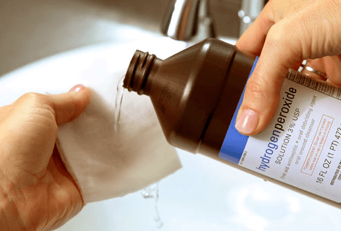 Using hydrogen peroxide