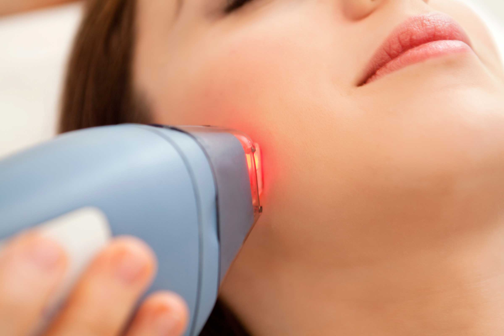 Laser Treatment for Dark Spots